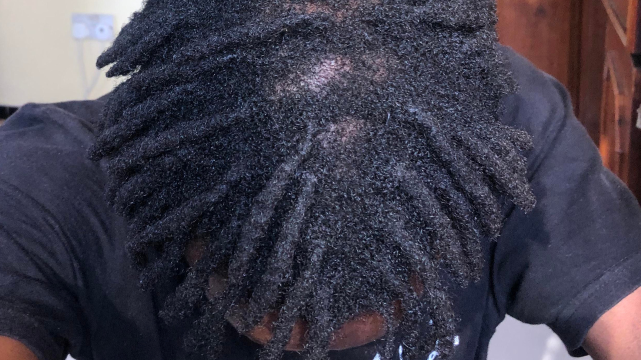 dread hair fall