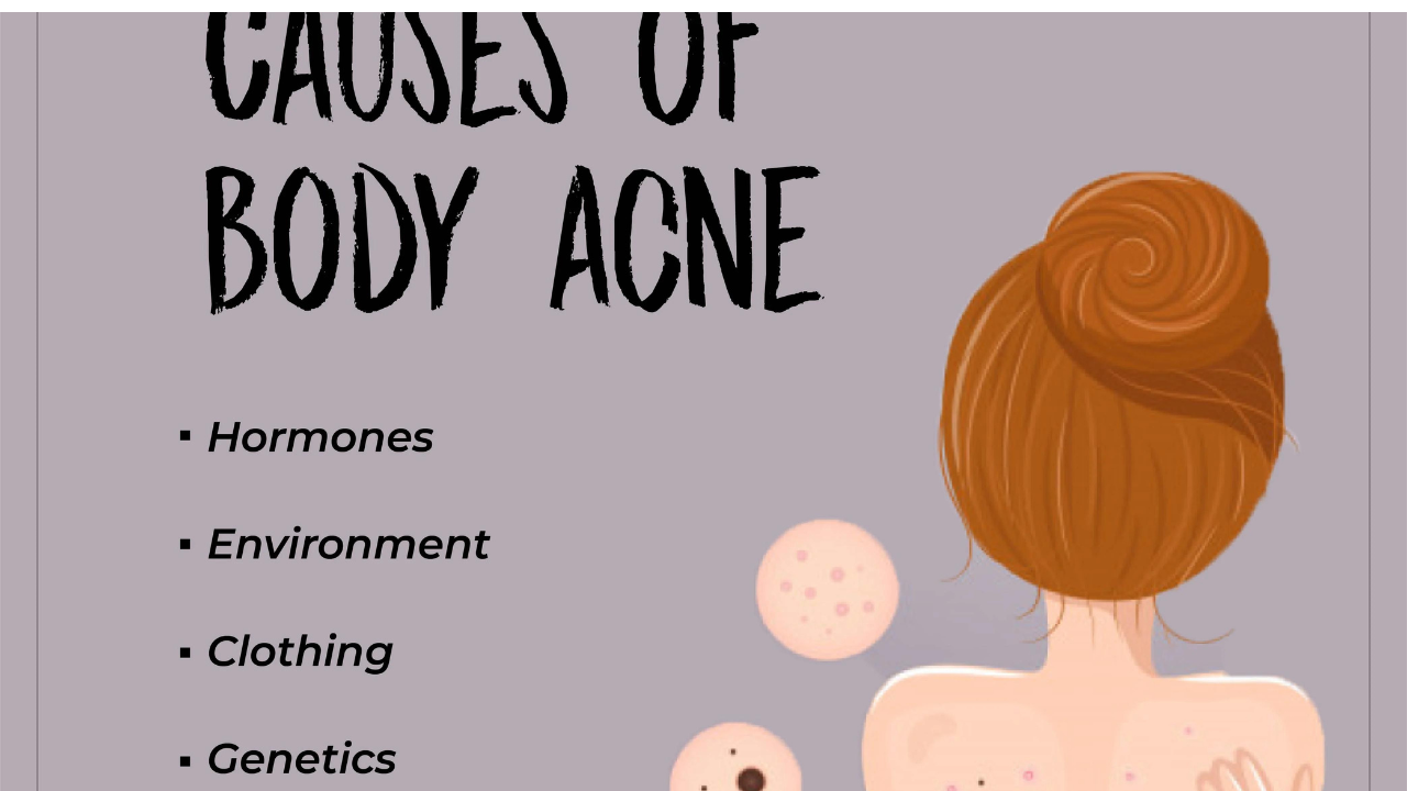 Reason for body Acne